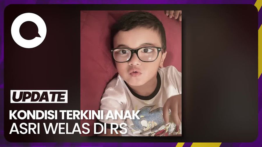 Anak Kedua Asri Welas Dirawat di ICU 