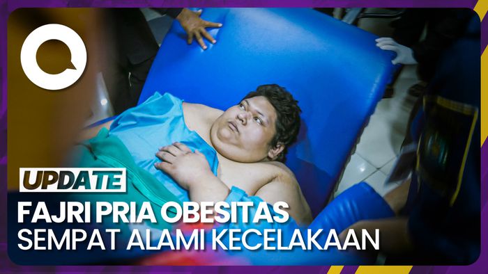 Pemicu Berat Badan Fajri Pasien Obesitas Membengkak hingga 300 Kg