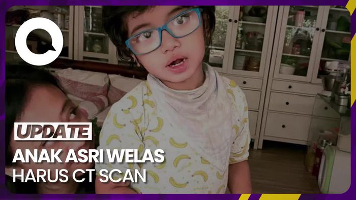 Sakit Anak Asri Welas Masih Belum Diketahui