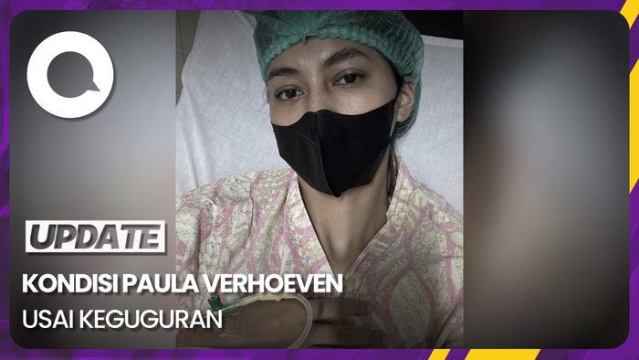 Kata Baim Wong soal Kondisi Paula Verhoeven Usai Alami Keguguran