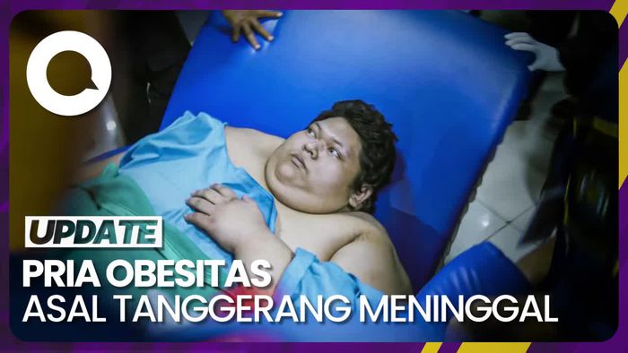 Pria Obesitas Asal Tangerang Meninggal Dunia, Sempat Alami Syok Septik