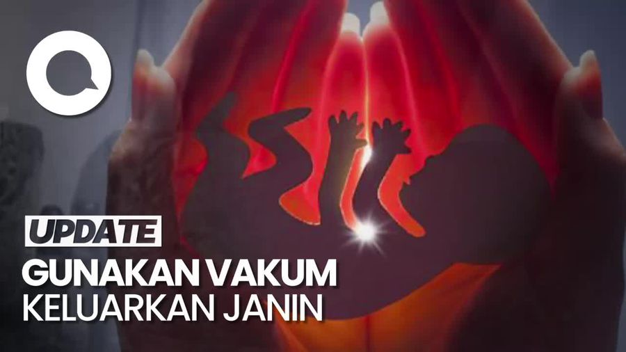 Klinik Aborsi di Kemayoran Gunakan Vakum Keluarkan Janin