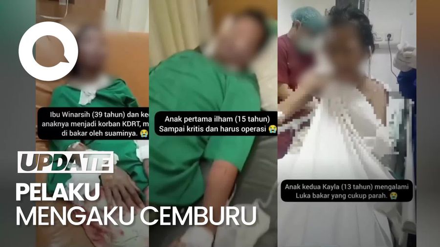Sadis! Suami Tega Bakar Istri dan Anaknya di Jaktim