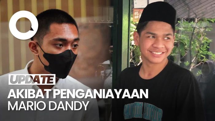 Dokter Sebut David Alami Kekacauan Motorik Usai Dianiaya Mario Dandy
