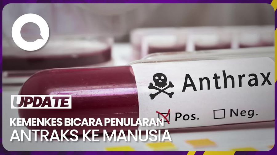 Kemenkes Tegaskan Antraks Tak Menular Antar Manusia 