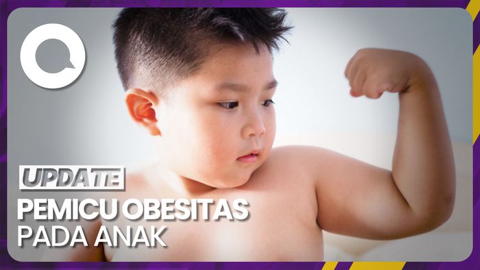 Kemenkes Ungkap Pemicu Obesitas pada Anak