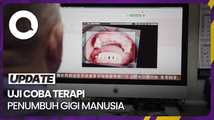  Ilmuwan Jepang Uji Coba Terapi Penumbuh Gigi Manusia