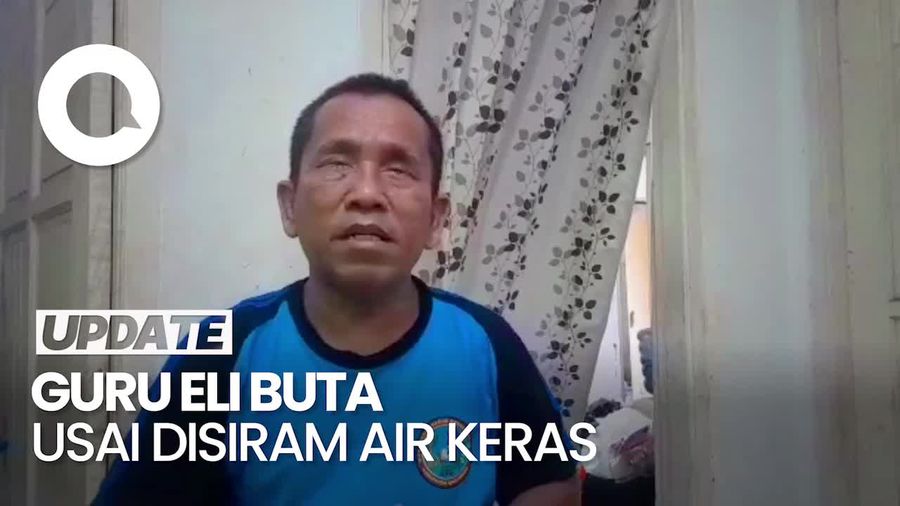 Pilu Guru Eli, Disiram Air Keras Rekan Bisnis Karena Sakit Hati