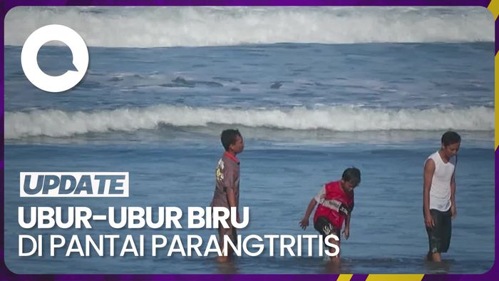 29 Wisatawan Pantai Parangtritis Kena Sengatan Ubur-ubur Biru