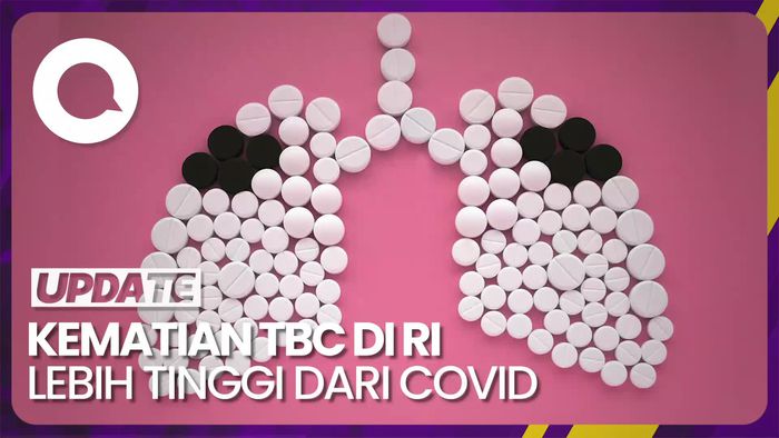 Menkes Budi Sebut Indonesia Peringkat 2 Penderita TBC Terbanyak di Dunia