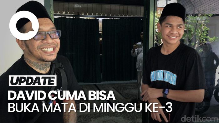 Dokter Cerita Kondisi David Usai Dianiaya: Membaik Ini Sebenarnya Mukjizat