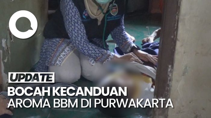 Anak yang Kecanduan Hirup Bensin di Purwakarta Kena Gangguan Saraf