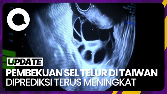 Permintaan Pembekuan Sel Telur Wanita Melonjak di Taiwan