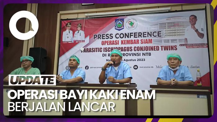 Hasil Operasi Pemisahan Bayi Kaki Enam di RSUP NTB