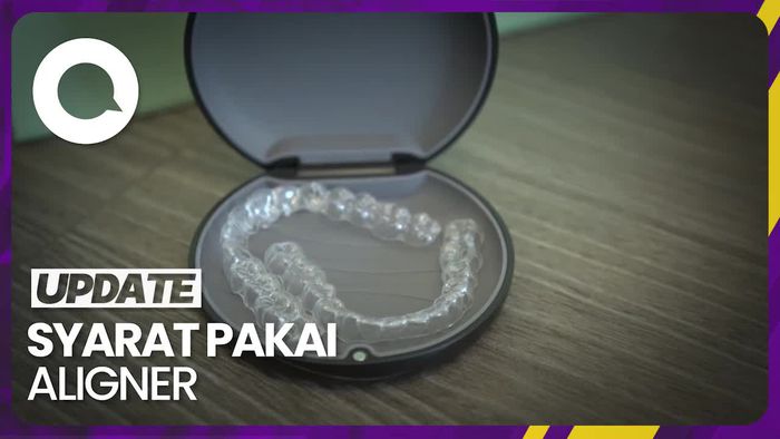 Kondisi Gigi Seperti Apa yang Bisa Menggunakan Aligner?