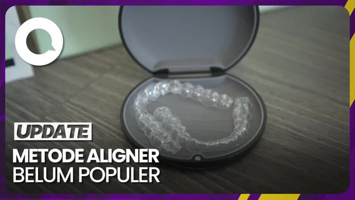 Mengapa Aligner Masih Jarang Digunakan di Indonesia?