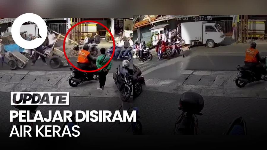 Aksi Barbar Pelajar Disiram Air Keras hingga Alami Luka Bakar