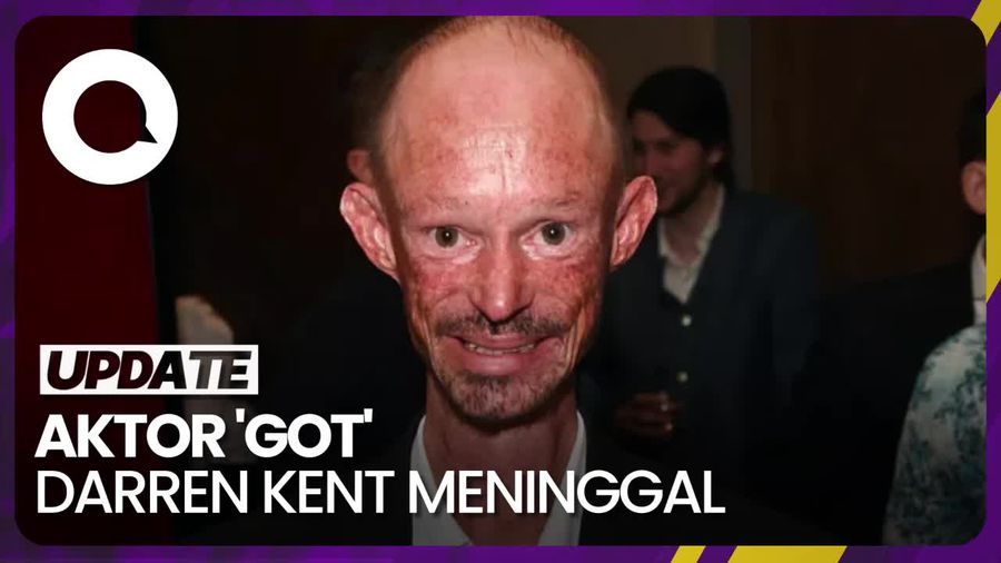 Aktor Game of Thrones Darren Kent Meninggal Dunia