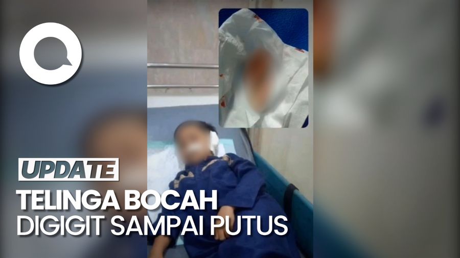 Telinga Bocah di Pasuruan Digigit Temannya Sampai Putus saat Ngaji