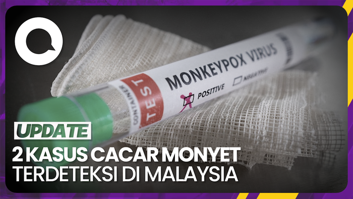 Malaysia Deteksi 2 Kasus Baru Cacar Monyet