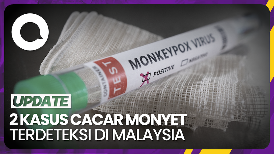 Malaysia Deteksi 2 Kasus Baru Cacar Monyet