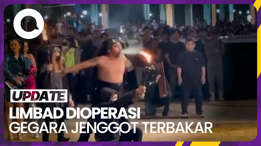 Kondisi Jenggot Limbat Usai Alami Insiden Terbakar