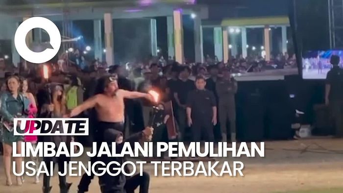 Fakta-fakta Insiden Jenggot Limbad Terbakar saat Aksi Sembur Api