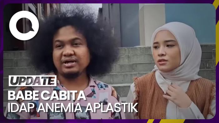 Cerita Babe Cabita Idap Penyakit Langka Anemia Aplastik