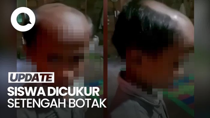 Penampakan Rambut Siswa di Samosir Dicukur Gurunya Sampai Setengah Botak