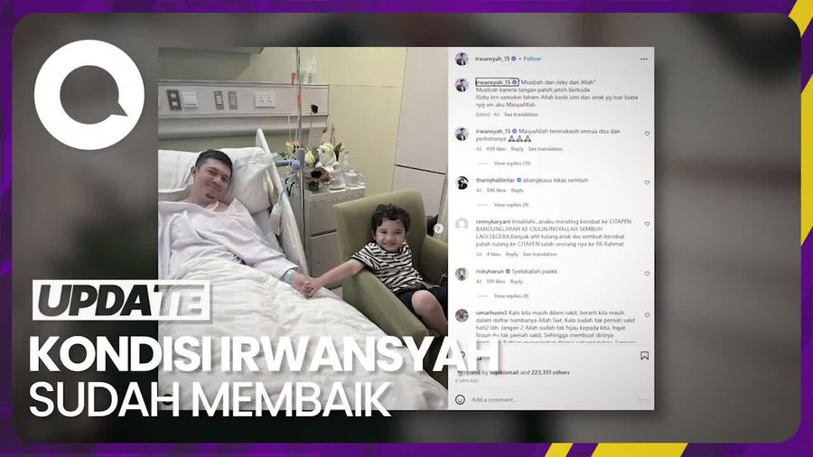 Kondisi Terbaru Irwansyah yang Alami Patah Tulang Gegara Jatuh saat Berkuda