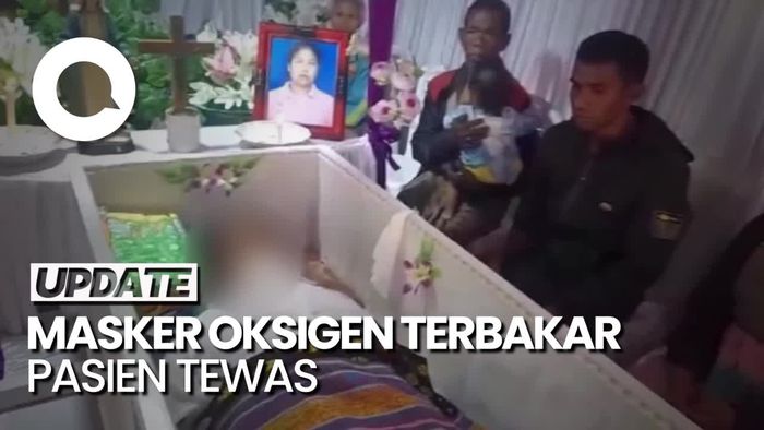 Pasien di RSUD Soe NTT Tewas Gegara Masker Oksigen Terbakar