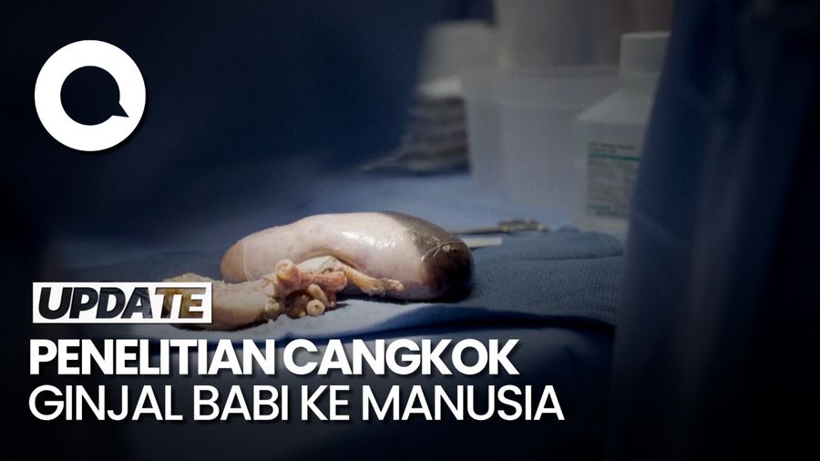 Ginjal Babi yang Dicangkok ke Tubuh Manusia Berhasil Bekerja Selama 2 Bulan