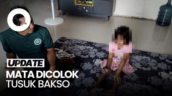 Sederet Fakta Pilu, Mata Siswi SD Dicolok Kakak Kelasnya hingga Buta