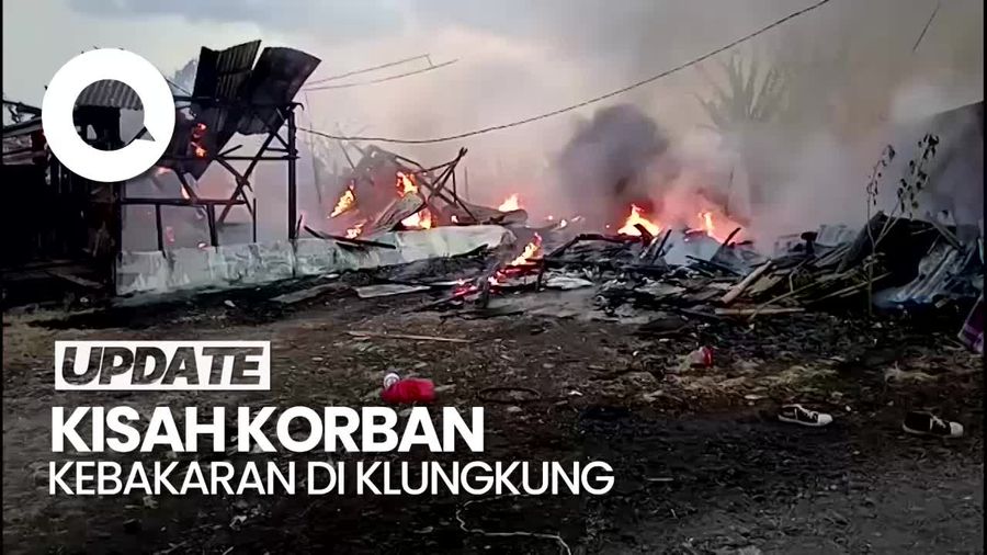 Kisah Pilu Rafli Korban Kebakaran Klungkung, Seragam dan Buku Hangus