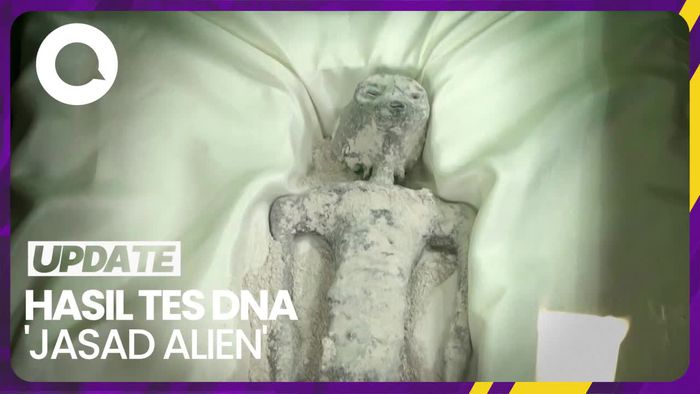  Jasad Alien di Meksiko Dites DNA: Belum Ada Kesamaan dengan Spesies Bumi