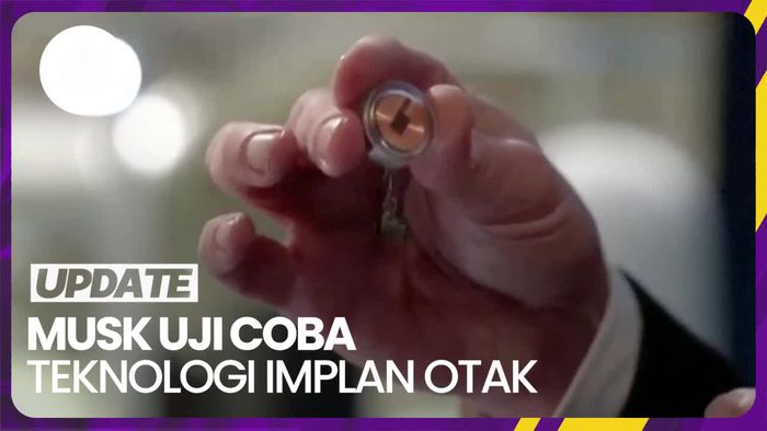 Elon Musk Mulai Uji Coba Tanam Chip Otak pada Manusia