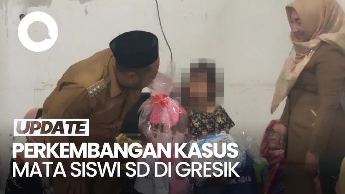 Kasus Mata Siswi SD Gresik: 156 Anak Diperiksa-Dicarikan Sekolah Baru