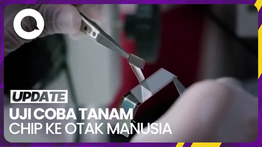Perusahaan Milik Elon Musk Bakal Tanam Chip di Otak Manusia