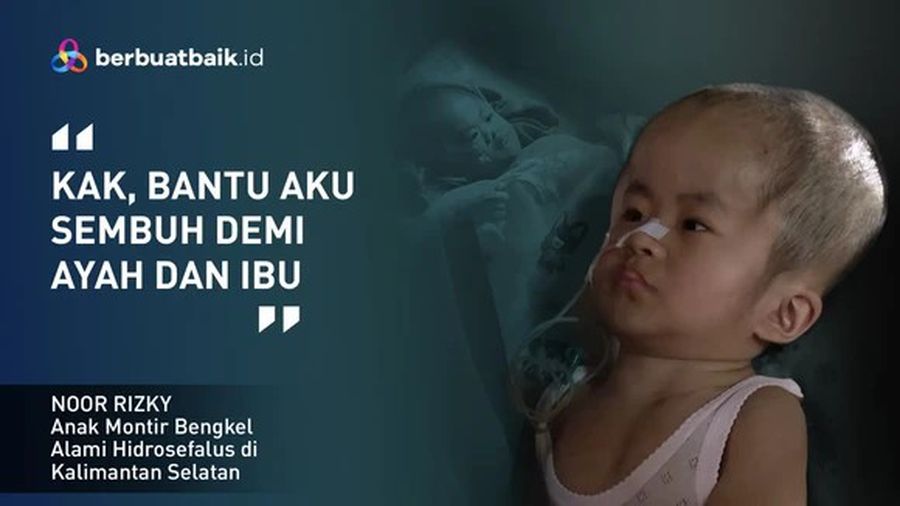 Perjuangan Keluarga Tukang Bengkel Jemput Kesembuhan Anak Hidrosefalus