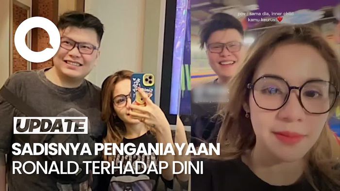Ronald Anak Anggota DPR Pukul Kepala-Lindas Dini hingga Terseret