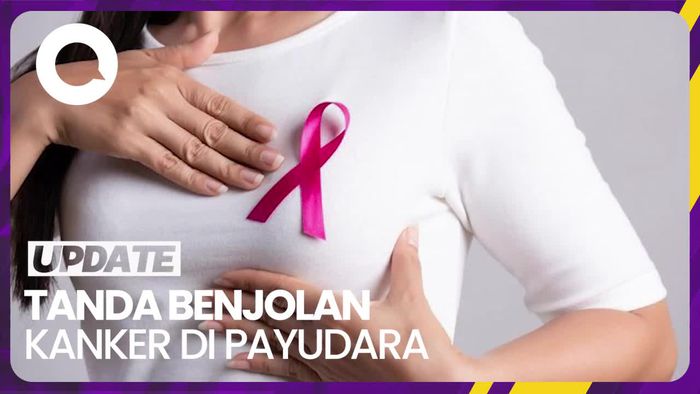 Tanda Benjolan Kanker Payudara yang Perlu Kamu Tahu