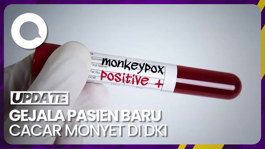 Gejala Awal Pasien Baru Cacar Monyet di DKI Sempat Dikira Jerawat
