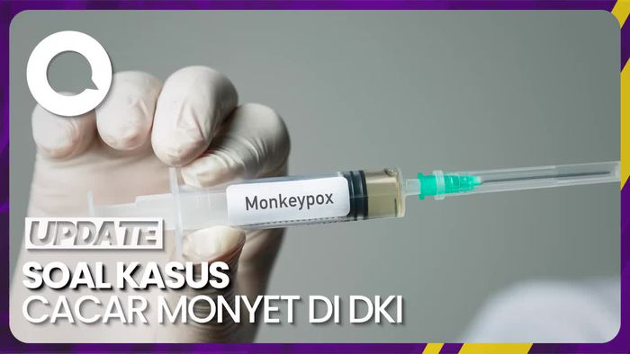Ada 7 Orang Kontak Erat dengan Kasus Cacar Monyet di DKI