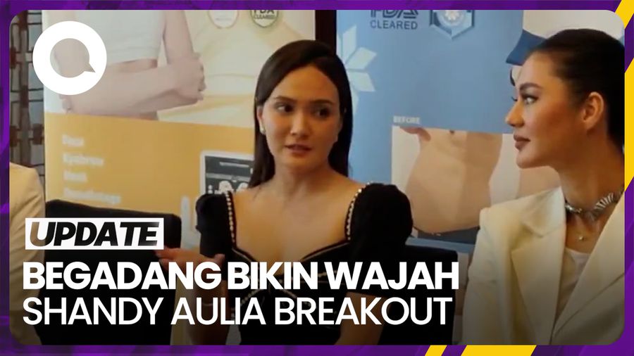 Shandy Aulia Panik Wajahnya Breakout, Ternyata Karena Sering Begadang