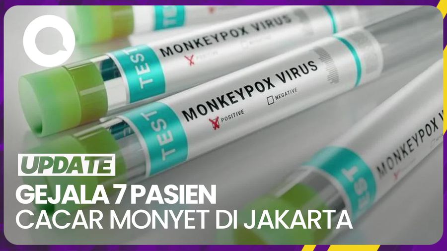 Gejala yang Dialami 7 Pasien Cacar Monyet di Jakarta
