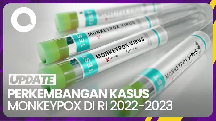 Perkembangan Kasus Monkeypox di Indonesia Setahun Terakhir