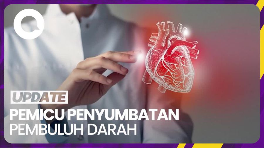 Dokter Beberkan Faktor Pemicu Penyumbatan Pembuluh Darah hingga Risiko