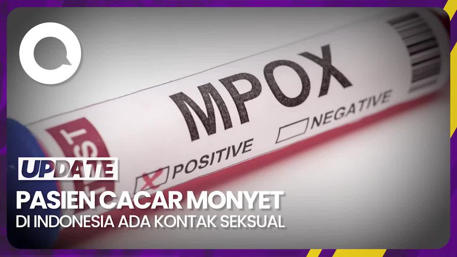 Tujuh Pasien Cacar Monyet di Indonesia Lakukan Kontak Seksual