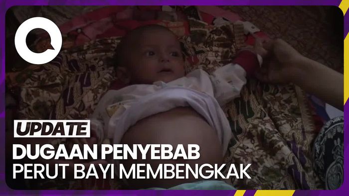 Viral Bayi 5 Bulan Disebut Hamil, Ini Hasil Diagnosisnya