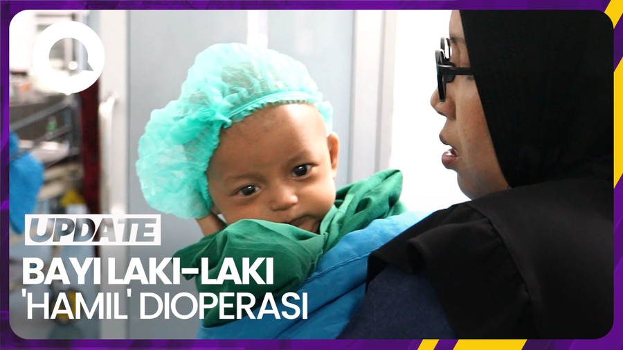 Bayi Laki-laki Jalani Operasi Pengangkatan Tumor di Sumbar